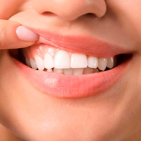 Cirurgia-plástica-peri-implantar