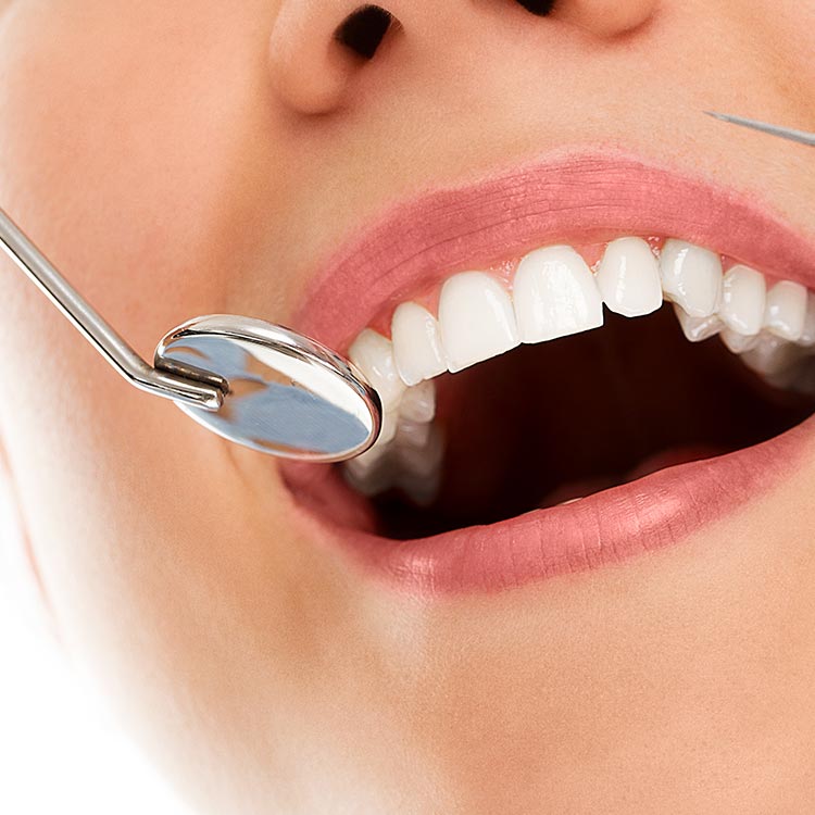 limpeza_dos_dentes_doutor_bianchine